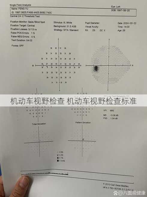 机动车视野检查 机动车视野检查标准