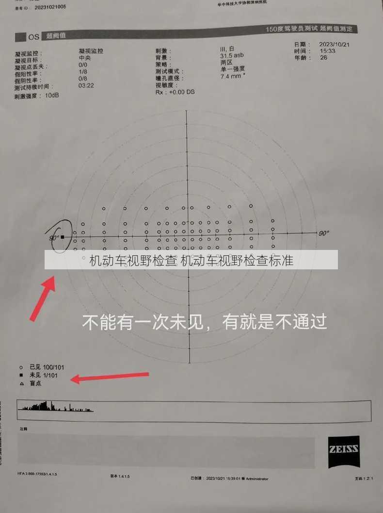 机动车视野检查 机动车视野检查标准